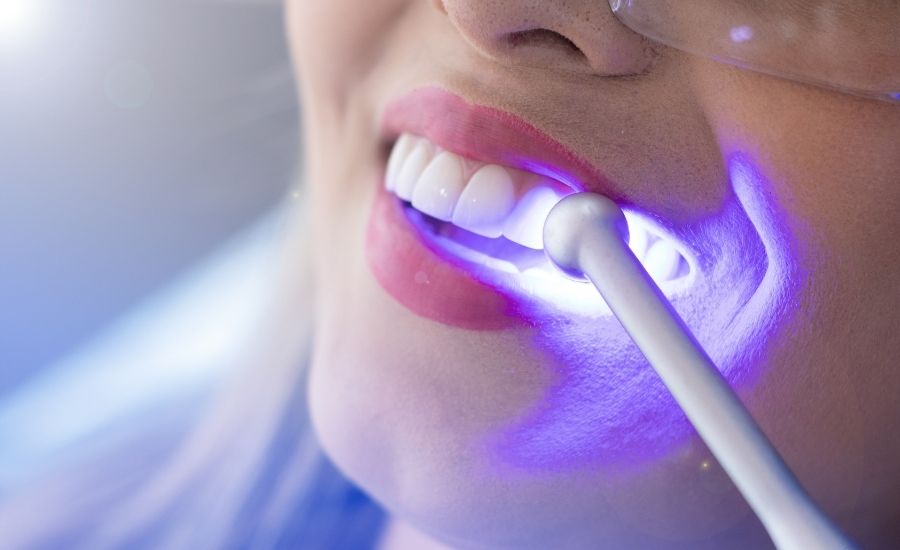 Teeth Whitening